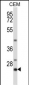 LIME1 Antibody (C-term)